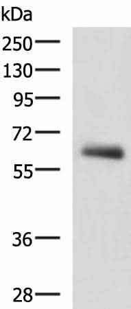 Anti-Human/Mouse KBTBD11 Antibody