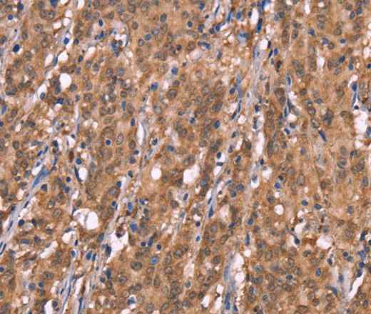 Anti-Human/Mouse/Rat FBXO31 Antibody