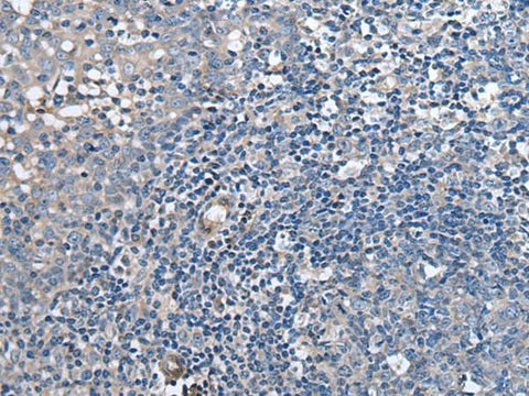 Immunohistochemistry of paraffin-embedded Human tonsil tissue using F3 Polyclonal Antibody at dilution of 1:60(×200)
