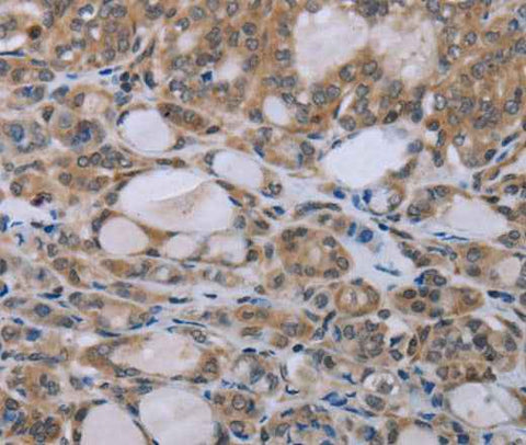 Anti-Human NAIP Antibody