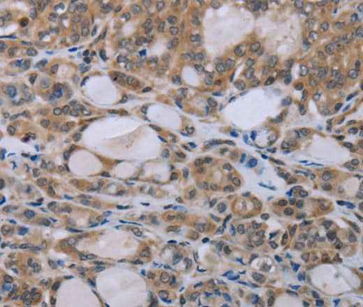 Anti-Human NAIP Antibody
