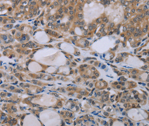 Anti-Human NAIP Antibody - ABMIUM