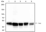 Anti-Human/Mouse TIA1 Antibody [A379]