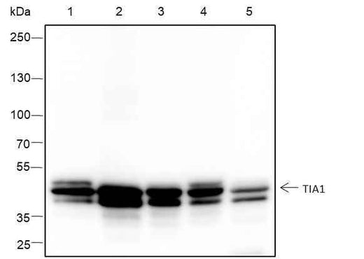 Anti-Human/Mouse TIA1 Antibody [A379] - ABMIUM