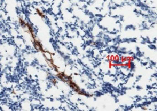 Anti-Human vWF Antibody [A1219] - ABMIUM