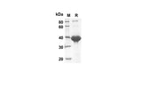 SDS-PAGE analysis of Rat CNTF proteins, 2 μg/lane of Recombinant Rat CNTF proteins was resolved with SDS-PAGE under reducing conditions, showing bands at 41.8. kDa.