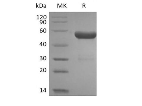 Recombinant Human HLA-A*0201 HPV16 E7 complex Protein (C-10His) - ABMIUM