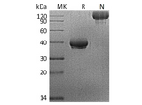Recombinant Human BCMA/TNFRSF17 Protein (Fc Tag) - ABMIUM