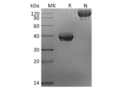 Recombinant Human BCMA/TNFRSF17 Protein (Fc Tag) - ABMIUM