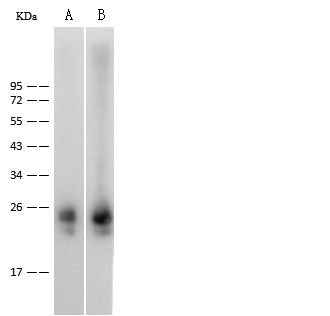 Anti-Mouse IL36B Antibody [B505] - ABMIUM