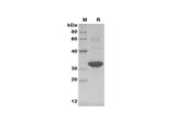 SDS-PAGE analysis of Mouse MCP-1 proteins,2 μg/lane of Recombinant Mouse MCP-1 proteins,was resolved with SDS-PAGE under reducing conditions,showing bands at 32 kDa.