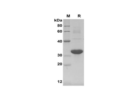SDS-PAGE analysis of Mouse MCP-1 proteins,2 μg/lane of Recombinant Mouse MCP-1 proteins,was resolved with SDS-PAGE under reducing conditions,showing bands at 32 kDa.