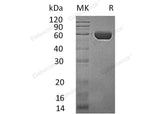 Recombinant Human CPVL/VCP-Like Protein (His Tag) - ABMIUM