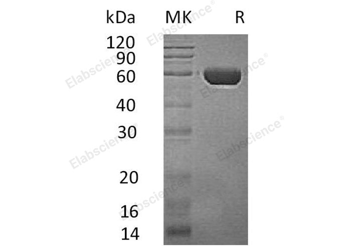 Recombinant Human CPVL/VCP-Like Protein (His Tag) - ABMIUM