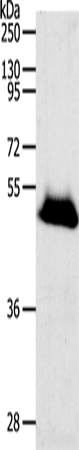 Anti-Human/Mouse RBMS3 Antibody - ABMIUM