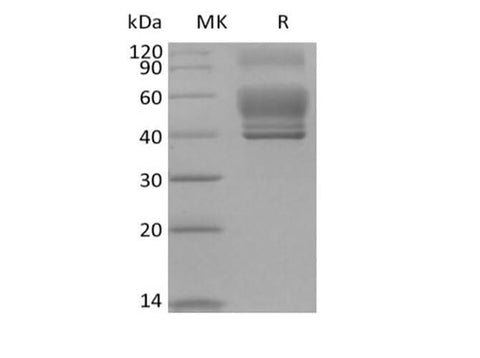 Recombinant Human Interleukin-13/IL-13 (C-Fc) - ABMIUM