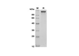 SDS-PAGE analysis of Mouse Cd163 proteins, 2 μg/lane of Recombinant Mouse Cd163 proteins was resolved with SDS-PAGE under reducing conditions, showing bands at 110-120 kDa.