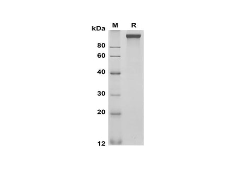SDS-PAGE analysis of Mouse Cd163 proteins, 2 μg/lane of Recombinant Mouse Cd163 proteins was resolved with SDS-PAGE under reducing conditions, showing bands at 110-120 kDa.