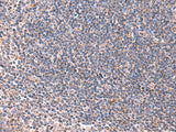 Immunohistochemistry of paraffin-embedded Human tonsil tissue using LIPA Polyclonal Antibody at dilution of 1:85(×200)