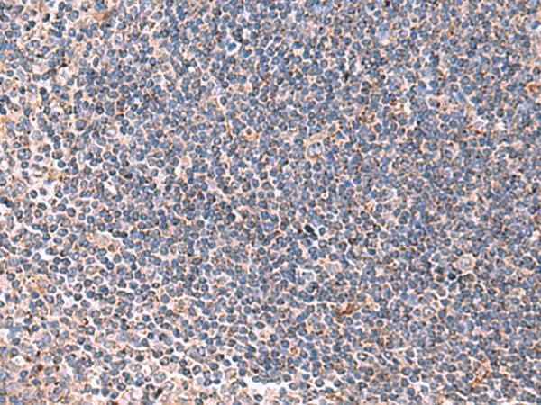 Anti-Human LIPA Antibody