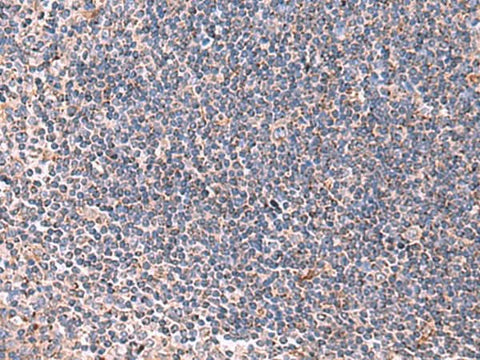 Immunohistochemistry of paraffin-embedded Human tonsil tissue using LIPA Polyclonal Antibody at dilution of 1:85(×200)