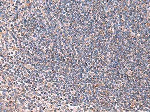 Immunohistochemistry of paraffin-embedded Human tonsil tissue using LIPA Polyclonal Antibody at dilution of 1:85(×200)