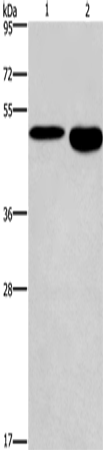 Anti-Human/Mouse/Rat DMRT3 Antibody - ABMIUM