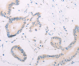 Anti-Human/Mouse/Rat MAP3K12 Antibody - ABMIUM