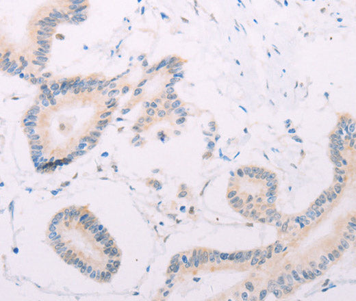Anti-Human/Mouse/Rat MAP3K12 Antibody - ABMIUM