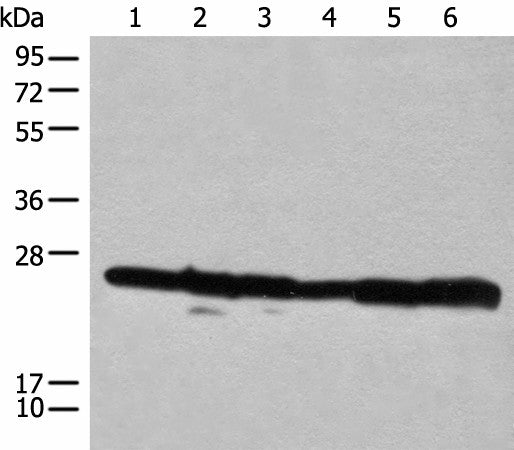 Western blot analysis of 293T cell lysates using RPL14 Polyclonal Antibody at dilution of 1:300