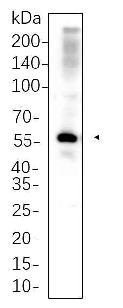 Anti-Human/Mouse/Rat PAX-8 Antibody [B629] - ABMIUM