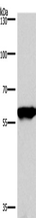 Anti-Human/Mouse/Rat PPP3CA Antibody - ABMIUM