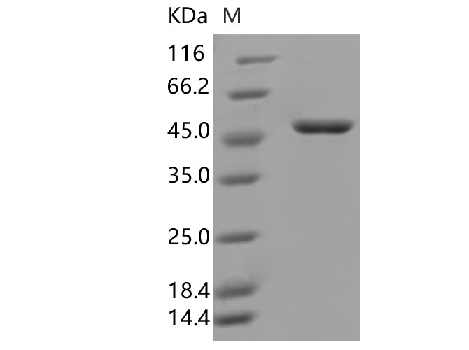 Recombinant SARS-CoV-2 N Protein (D3L,R203K,G204R,S235F)(His Tag) - ABMIUM