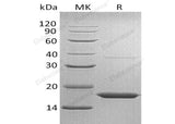 Recombinant Human Transthyretin/TTR Protein (His Tag) - ABMIUM