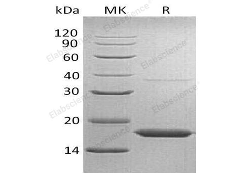 Recombinant Human Transthyretin/TTR Protein (His Tag) - ABMIUM