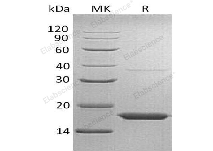 Recombinant Human Transthyretin/TTR Protein (His Tag) - ABMIUM
