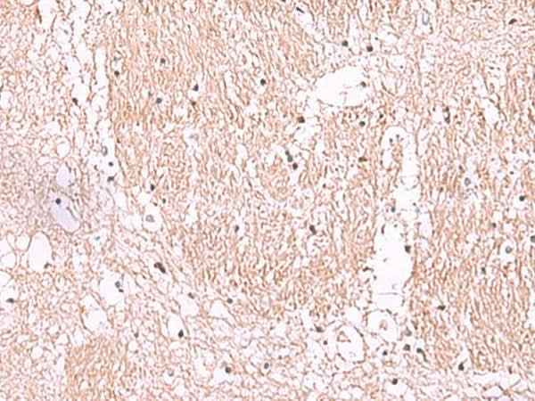 Anti-Human/Mouse/Rat RIC8A Antibody