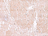 Immunohistochemistry of paraffin-embedded Human brain tissue using RIC8A Polyclonal Antibody at dilution of 1:55(×200)