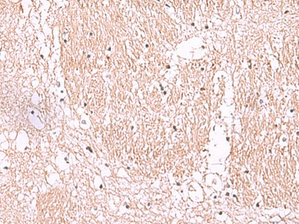 Immunohistochemistry of paraffin-embedded Human brain tissue using RIC8A Polyclonal Antibody at dilution of 1:55(×200)