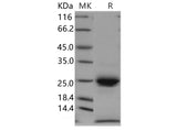 Recombinant Human Kallikrein 6/KLK6 Protein (His Tag) - ABMIUM