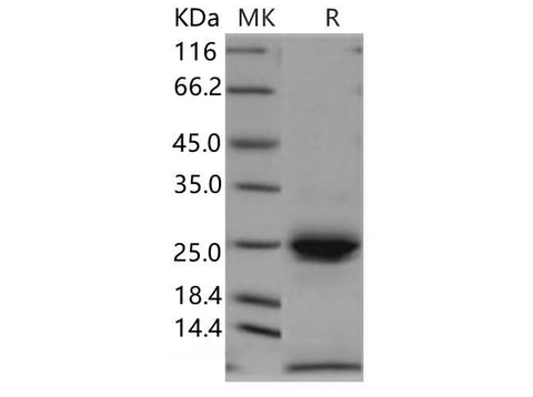 Recombinant Human Kallikrein 6/KLK6 Protein (His Tag) - ABMIUM