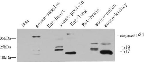 Western Blot analysis of various cells using Cleaved-CASP3 p17 (D175) Polyclonal Antibody at dilution of 1:1000.