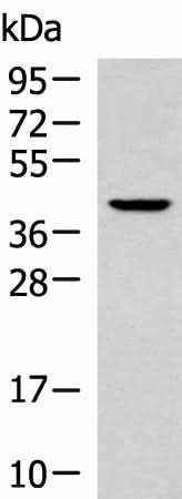 Anti-Human/Mouse/Rat KLF6 Antibody
