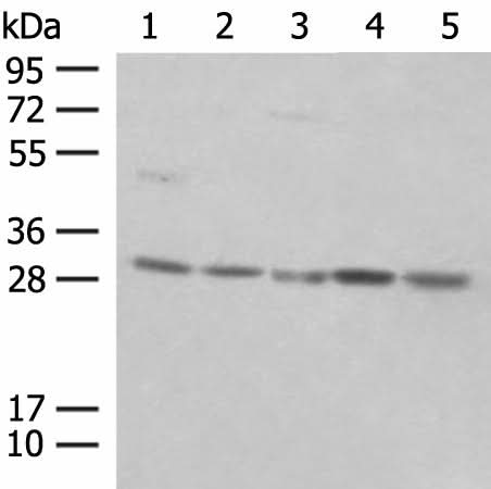 Western blot analysis of NIH/3T3 cell Mouse spleen tissue K562 cell Hela cell 231 cell lysates using PSMA4 Polyclonal Antibody at dilution of 1:400