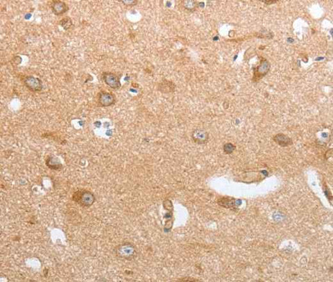 Anti-Human/Mouse CASP12 Antibody