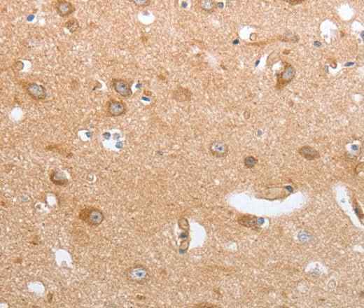 Anti-Human/Mouse CASP12 Antibody