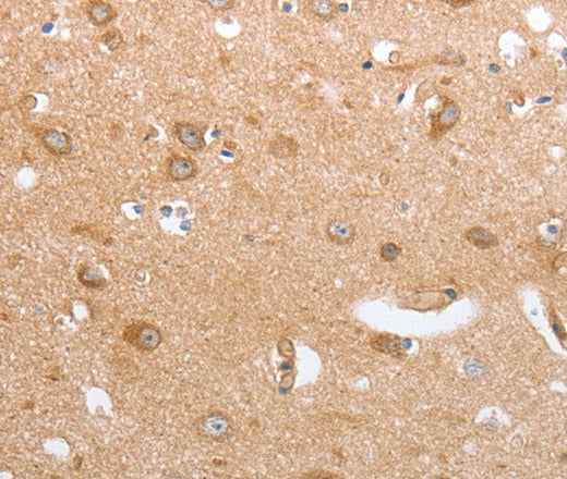 Anti-Human/Mouse CASP12 Antibody - ABMIUM