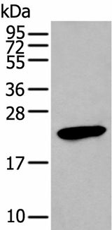 Western blot analysis of Human stomach tissue lysate using GKN1 Polyclonal Antibody at dilution of 1:250