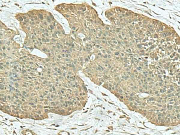Anti-Human/Mouse FN3KRP Antibody