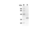 SDS-PAGE analysis of Mouse Ccl24 proteins, 2 μg/lane of Recombinant Mouse Ccl24 proteins was resolved with an SDS-PAGE under reducing conditions, showing bands at 30.1 kDa.